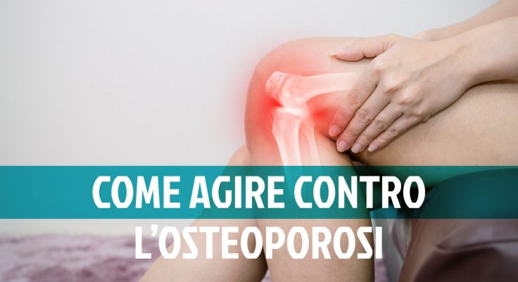 Prevenzione dell'osteoporosi: tutti i consigli
